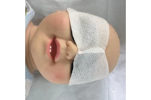 Newborn Phototherapy Eye Shield