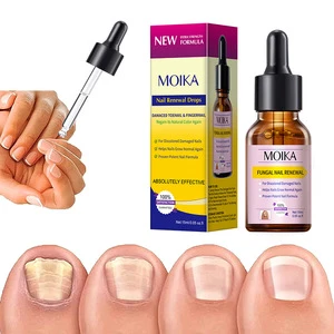 7 Days Nails Fungus Repair Serum Solution Nourishing Damage Nail Natural Nails Treatment Serum