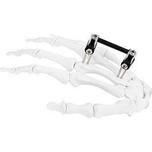 Professional Grade Long AL Mini Fixator Universal Compression Extension Type Instrument Kit By Jinlu Medical