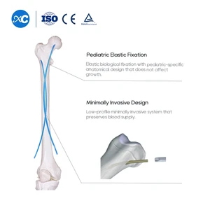 Orthopedics Medical Bone Surgery Implant Child Titanium Elastic Nail Pediatric Intramedullary Interlocking Nail Elastic Ten Nail