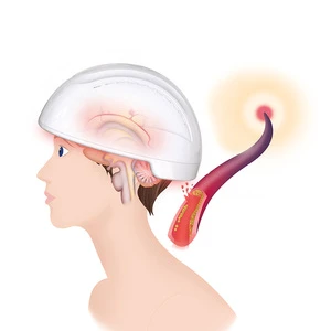 Brain Neuron Feedback Stimulation Device 810nm Near Infrared Oxygen Blood Improvement Photobiomodulation Helmet For Anxiety